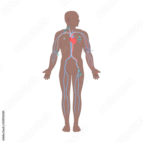 Central venous catheter placement sites shown on the male body. Types of central lines. Man with CVC access devices. PICC, arterial line, implantable port for infusion. Medical vector illustration.
