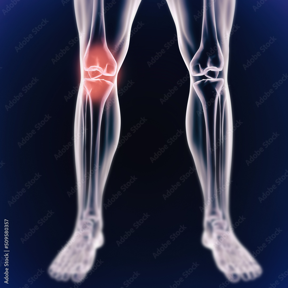Knee and joint pains. When inflammation strikes. Illustration of the human body indicating the skeletal structure. Knee and joint pains. When inflammation strikes. Illustration of the human body indicating the skeletal structure.