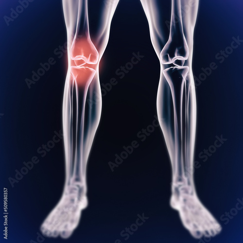 Knee and joint pains. When inflammation strikes. Illustration of the human body indicating the skeletal structure.