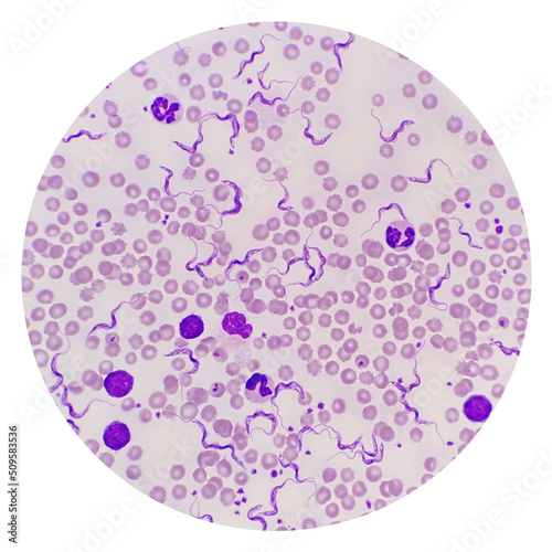 Trypanosoma sp. among red blood cells. Trypanosome species in blood from cattle.  Trypanosoma is a protozoan parasite that is the causative agent of the animal disease trypanosomiasis or ‘Surra’
