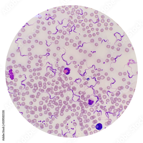 Trypanosoma sp. among red blood cells. Trypanosome species in blood from cattle.  Trypanosoma is a protozoan parasite that is the causative agent of the animal disease trypanosomiasis or ‘Surra’