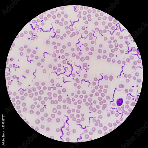 Trypanosoma sp. among red blood cells. Trypanosome species in blood from cattle.  Trypanosoma is a protozoan parasite that is the causative agent of the animal disease trypanosomiasis or ‘Surra’