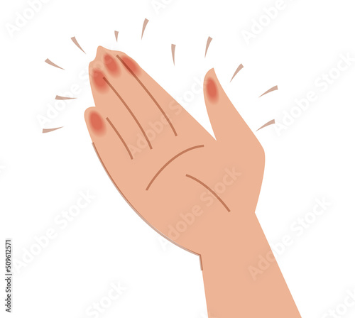 Tingling in hand vector isolated. Numbness in arm, medical symptom. Numb nerves in fingers. Itching feeling.