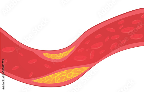Vascular blood artery. vector illustration