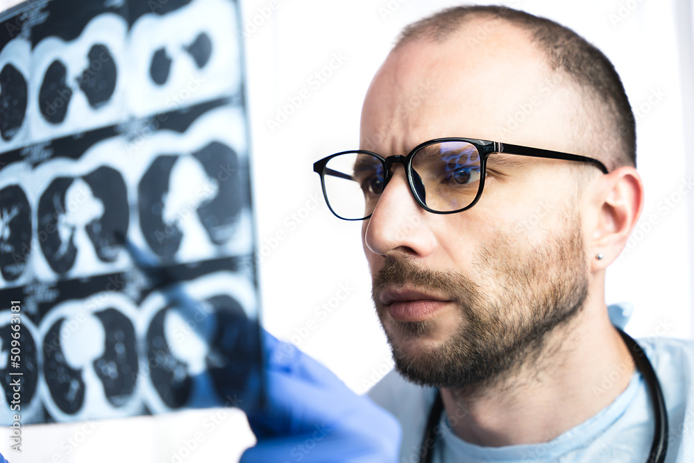 A man doctor in glasses holds a computed tomography in his hands and examining the picture. Pneumonia, bronchitis, coronavirus. Diagnosis of the disease in the early stages. Close-up. A man doctor in glasses holds a computed tomography in his hands and examining the picture. Pneumonia, bronchitis, coronavirus. Diagnosis of the disease in the early stages. Close-up.