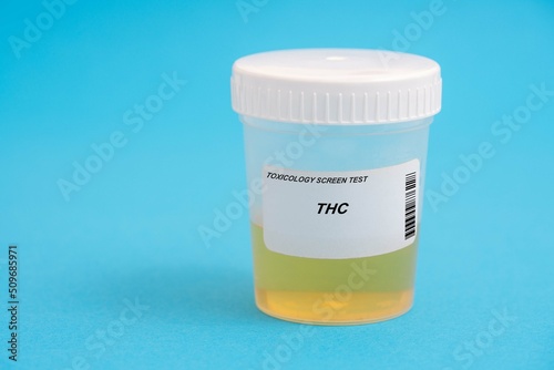 THC. THC toxicology screen urine tests for doping and drugs photo