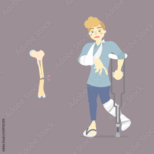 sad patient with cast on broken leg and arm bone holding crutch, walking aid, internal organs body part orthopedic healthcare, fracture  concept, flat vector illustration character cartoon design
