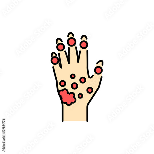 Psoriatic Arthritis color line icon. Pictogram for web page photo