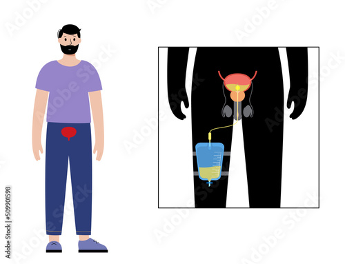 Urinary drainage bag