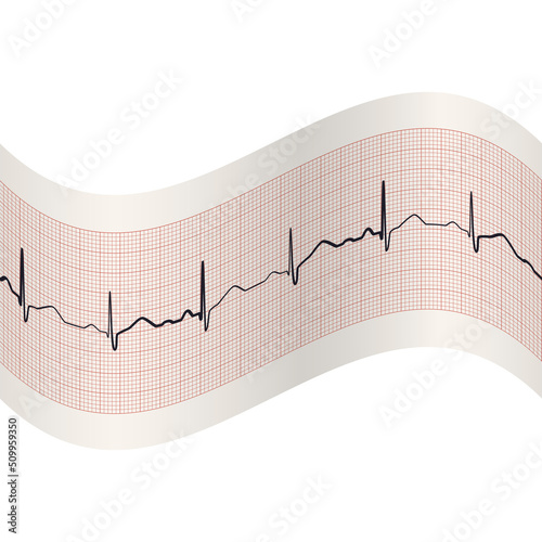 Electrocardiogram seamless background. Heart beat rate recording on pink ekg paper. Millimeter graph and curve of cardiology rhythm. Medical vector design for hospital page, banner