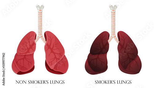 Illustration of normal healthy lungs and lungs smoker. Concept of stop smoking. Vector illustration.