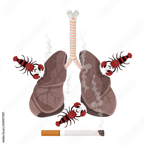 Illustration of lung smoker, lung cancer disease. The concept of stop smoking. Vector illustration.