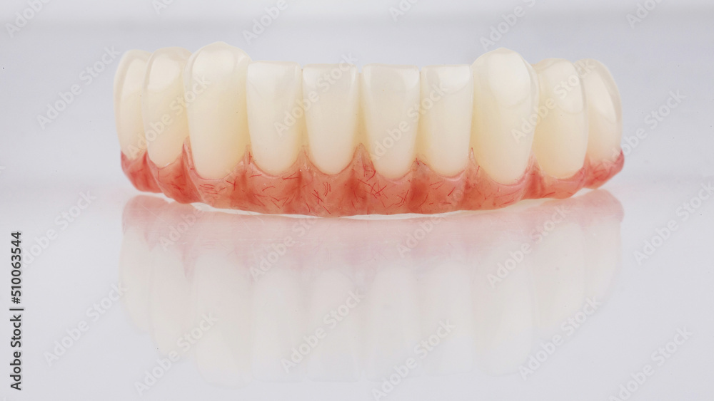 temporary prosthesis made of plastic with artificial gum for the lower jaw on a white background temporary prosthesis made of plastic with artificial gum for the lower jaw on a white background