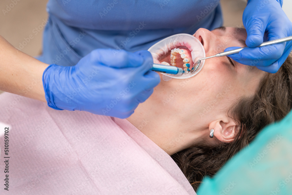 Anonymous Dentist Adjusting Brackets To Patient Anonymous Dentist Adjusting Brackets To Patient