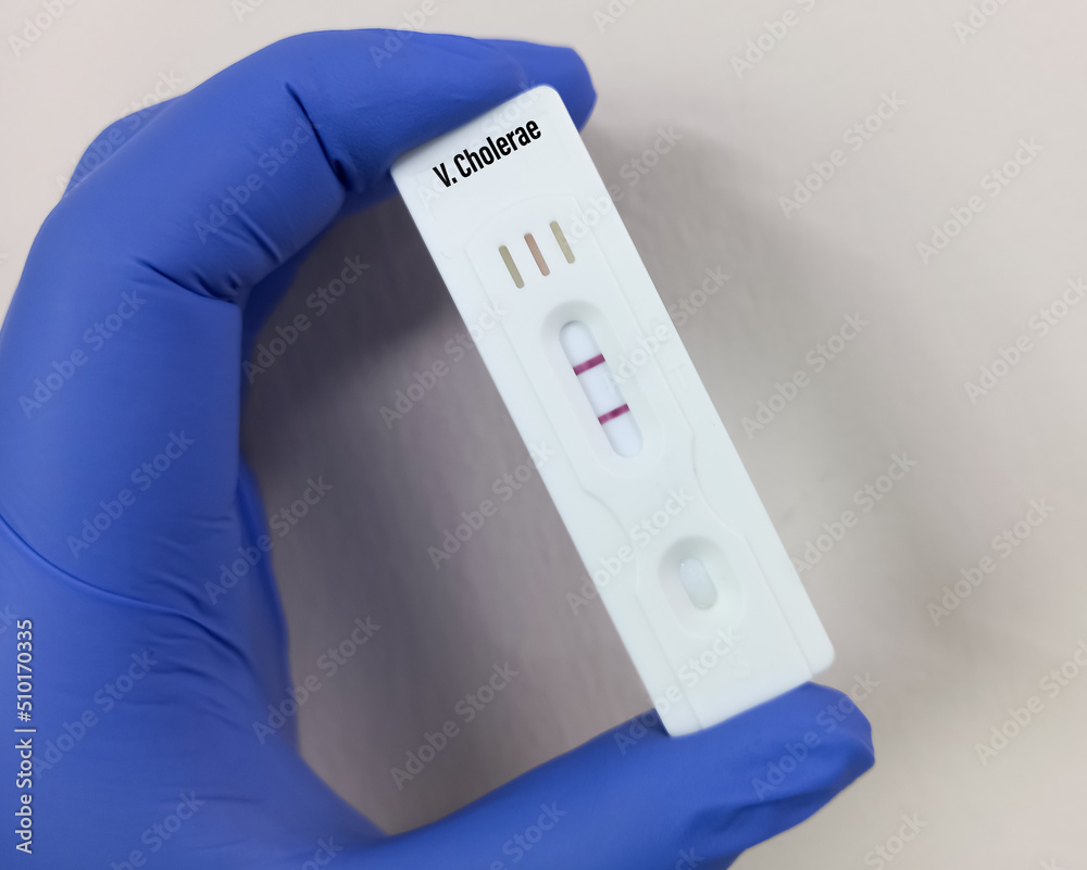 Rapid test cassette or kit for Vibrio cholerae test, show positive result, Laboratory Testing for Cholera.