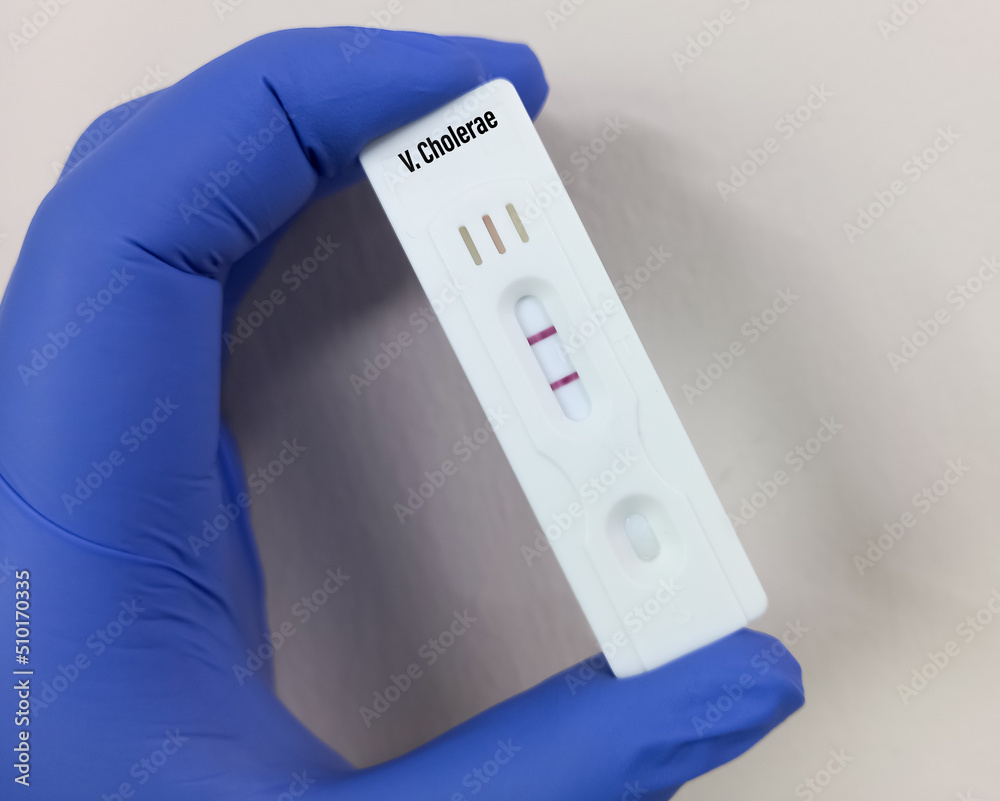 Rapid test cassette or kit for Vibrio cholerae test, show positive result, Laboratory Testing for Cholera. Rapid test cassette or kit for Vibrio cholerae test, show positive result, Laboratory Testing for Cholera.
