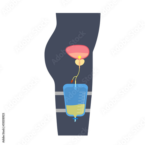 Urinary drainage bag