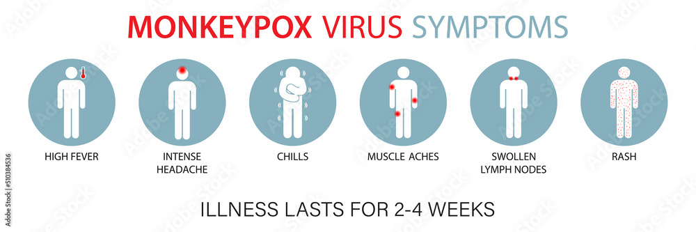 Symptoms of the monkey pox virus. Monkey pox is spreading. This causes ...