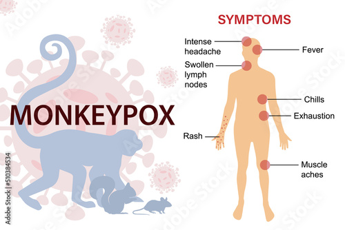 Symptoms of the monkey pox virus. The epidemic virus spreads from animals such as monkeys, squirrels, rats.  This causes skin infections.
