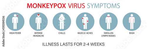 Symptoms of the monkey pox virus. Monkey pox is spreading. This causes skin infections. Infographic of symptoms of the monkey pox virus