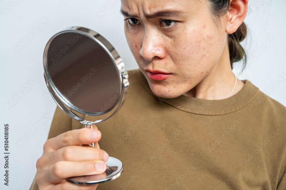 Portrait of Asian woman worry about her face when she saw the problem of acne inflammation and scar by the mini mirror. Portrait of Asian woman worry about her face when she saw the problem of acne inflammation and scar by the mini mirror.