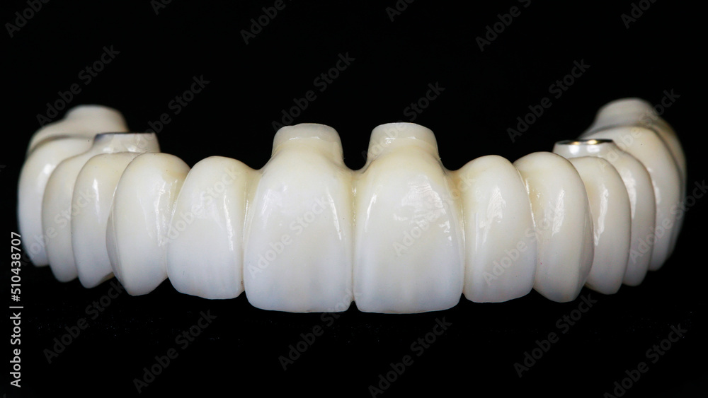 dental prosthesis from zircon on implants on a black background dental prosthesis from zircon on implants on a black background