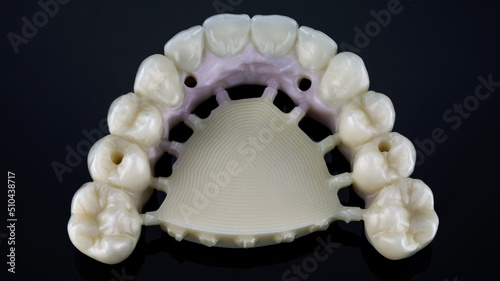 dental prosthesis of the upper jaw without processing technique, top view on a black background