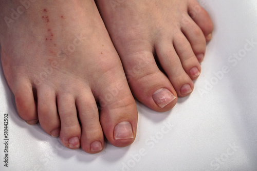 Pedicure on female feet close-up. Procedures in a beauty salon.