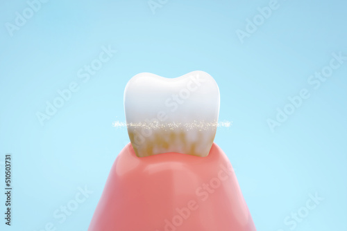 Obraz na plátně Clean teeth from yellow to white by Dental technic or Toothpaste