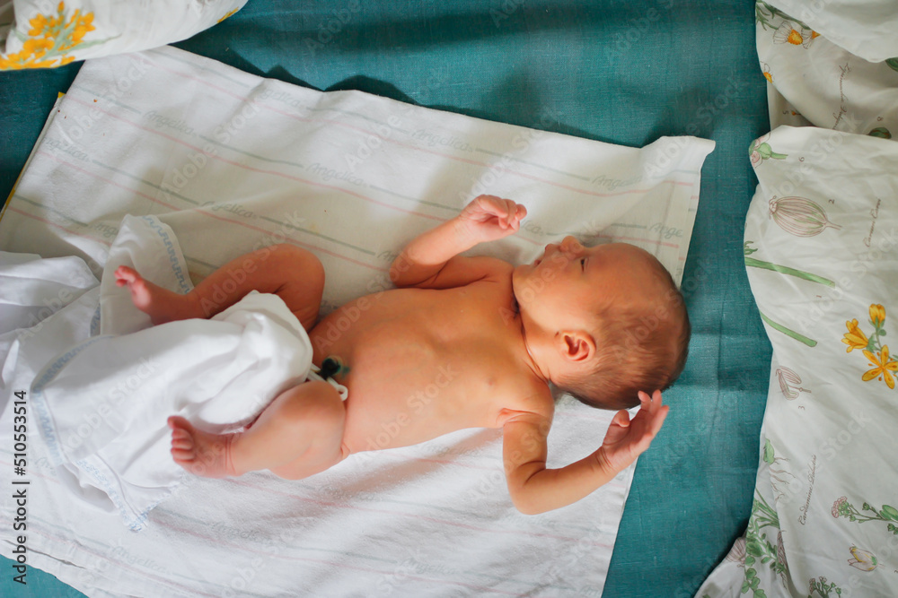 Newborn baby with clip on umbilical cord on diaper on bed top view. Gentle innocent baby lies at home Stock Foto Adobe Stock