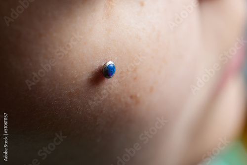 Photo of piercing in the girl, crystal in the middle of clavicles. Microdermal. photo