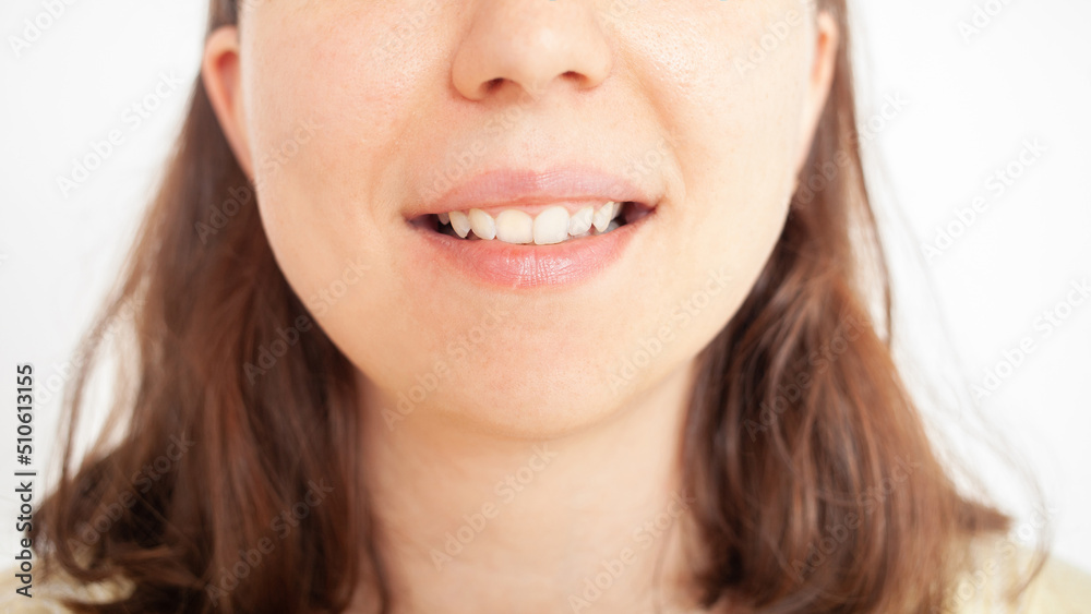 Woman smiles, white teeth after brushing and whitening Woman smiles, white teeth after brushing and whitening