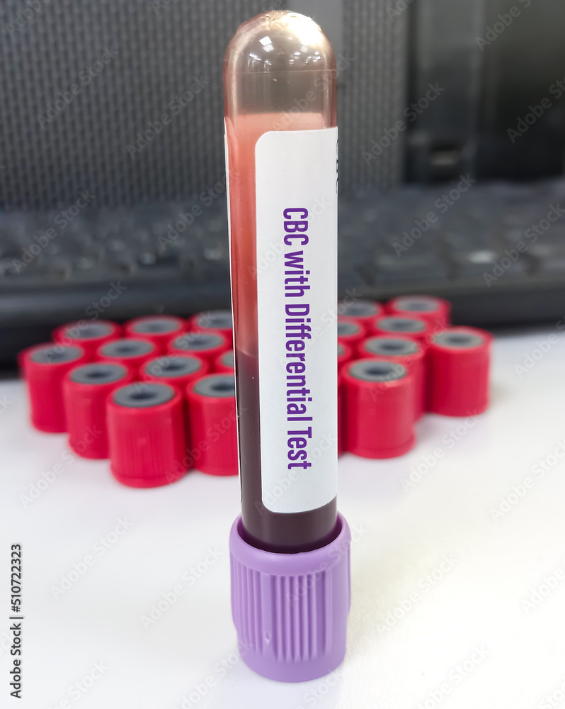Blood sample tube for CBC with differential test. Complete blood count