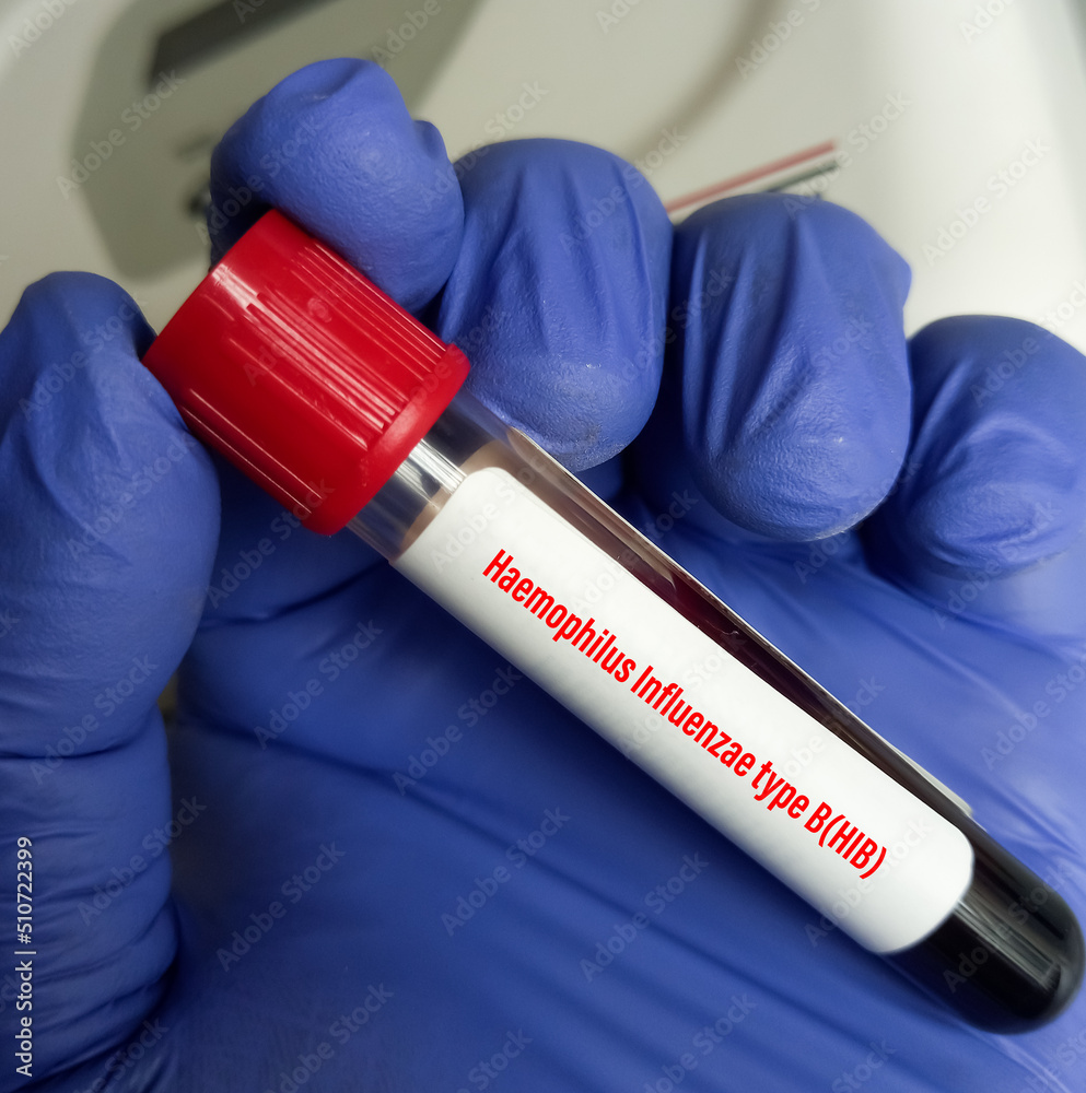 Technologist holding a blood sample for Haemophilus Influenzae Type B