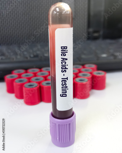 Blood sample for Bile Acids testing to diagnose hepatobiliary diseases and intrahepatic cholestasis of pregnancy. photo