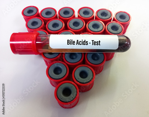 Blood sample for Bile Acids test to diagnose hepatobiliary diseases and intrahepatic cholestasis of pregnancy. photo