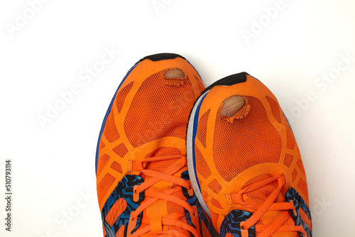 Worn, holey running shoes with real legs sticking out of them