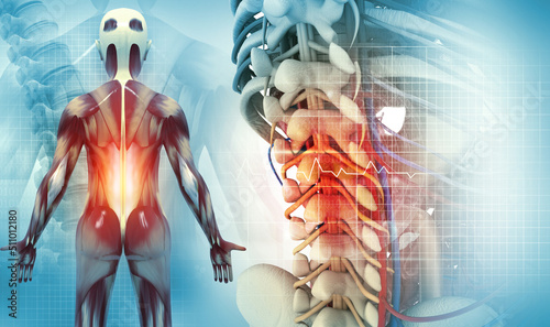 Fototapeta Naklejka Na Ścianę i Meble -  Spine cancer or spinal disease, 3d illustration