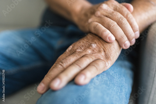 Elderly man suffering from psoriasis on hands