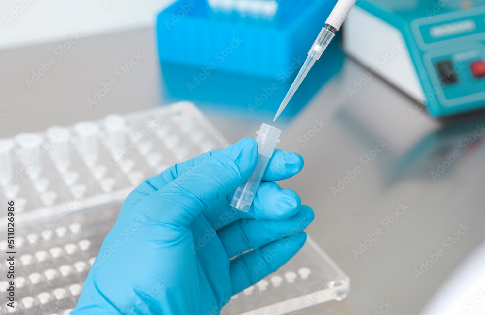 hands of a lab technician with a tube of blood sample and a rack with other samples / lab technician holding blood tube sample for study.Corona virus pandemic concept.Coronavirus vaccine development hands of a lab technician with a tube of blood sample and a rack with other samples / lab technician holding blood tube sample for study.Corona virus pandemic concept.Coronavirus vaccine development