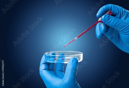 Photography Lab scientist performing a rapid diagnostic test RDT for antibodies by COVID-19