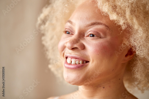 Studio Portrait Shot Of Confident Natural Albino Woman In Underwear Promoting Body Positivity photo