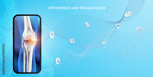 Technology for treatment of knee bone. Abstract traumatology and orthopedics. Medical science in the hospital for body joints.