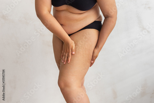 Unrecognizable overweight woman with sag hips, obesity, excess fat in lingerie on white isolated background. Squeezing cellulite thigh. Gaining weight after childbirth flabs, overeating problems photo