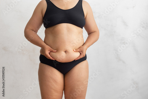 Принти на полотні Unrecognizable overweight obese woman in black bikini touching and squeezing big dangling tummy