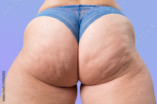 Overweight thigh, woman with fat hips and buttocks, obesity female body with cellulite on gray background