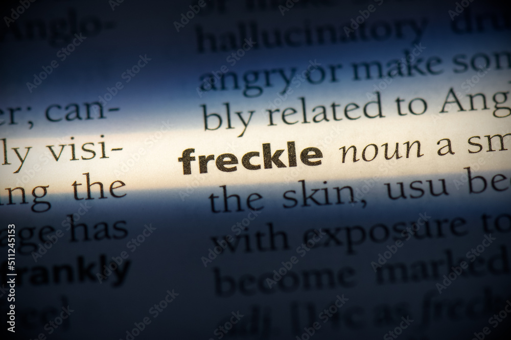 freckle