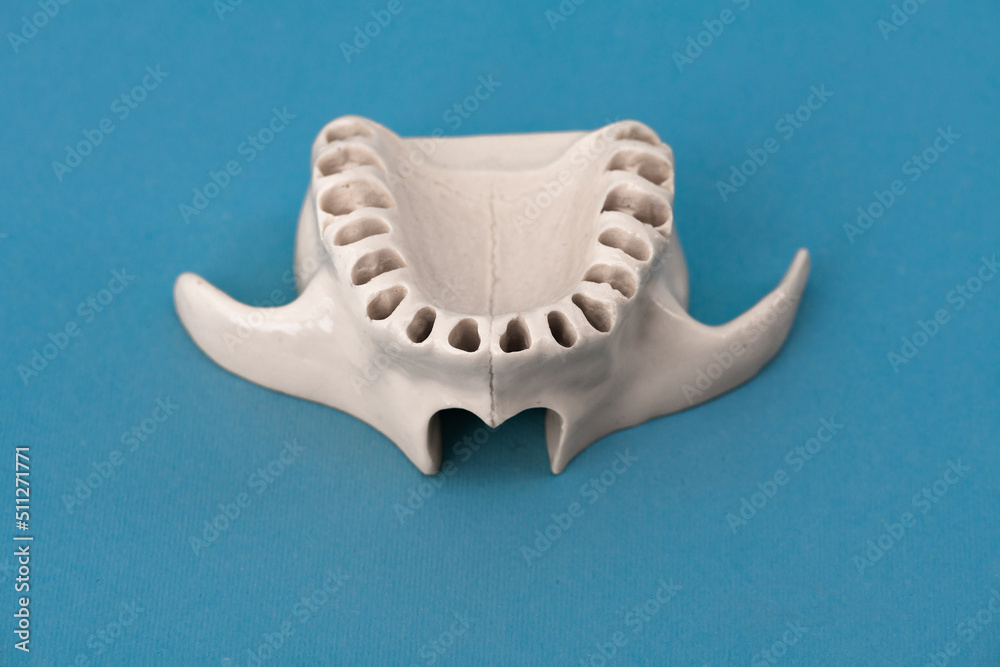 Upper human jaw without teeth model medical implant isolated on blue background. Healthy teeth, dental care and orthodontic concept.