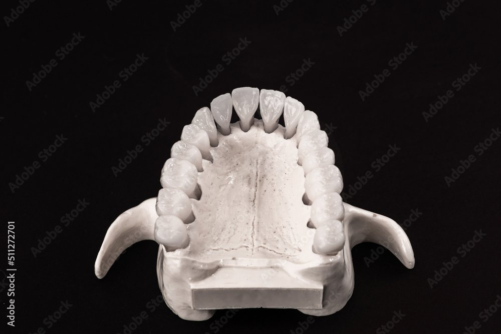 Lower human jaw with teeth anatomy model isolated on black background. Healthy teeth, dental care and orthodontic medical concept. Lower human jaw with teeth anatomy model isolated on black background. Healthy teeth, dental care and orthodontic medical concept.