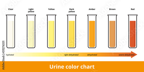 Urine color chart.	Pee hydration and dehydration test strip. Urine in test tubes with color depicting its hydration or dehydration level.